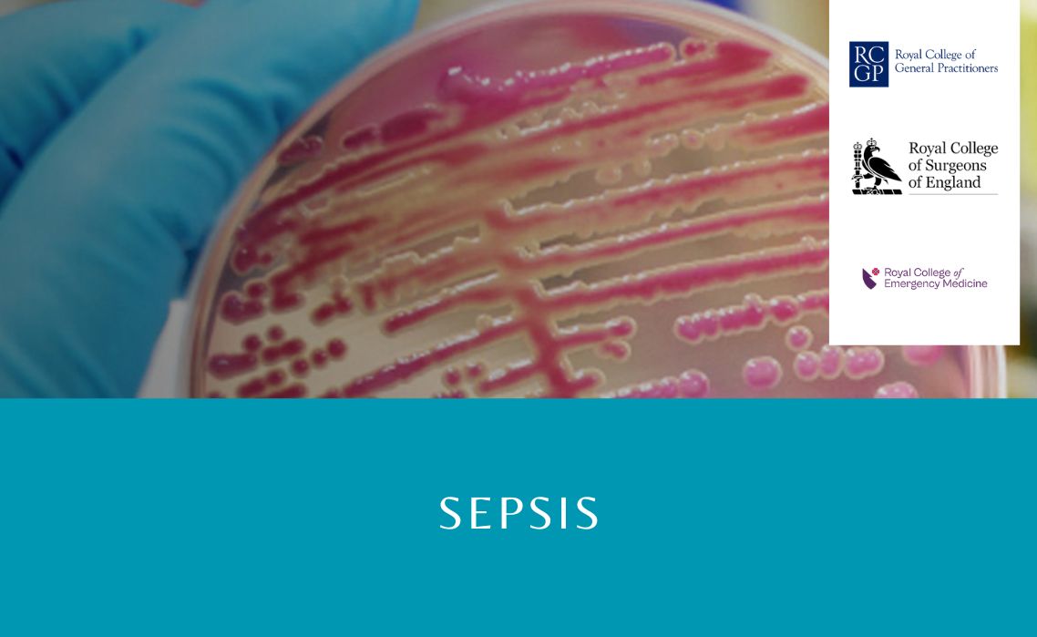 Sepsis