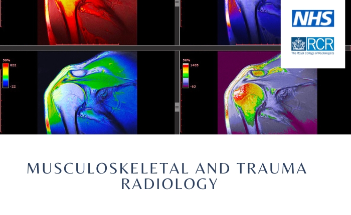 Musculoskeletal and Trauma – Radiology