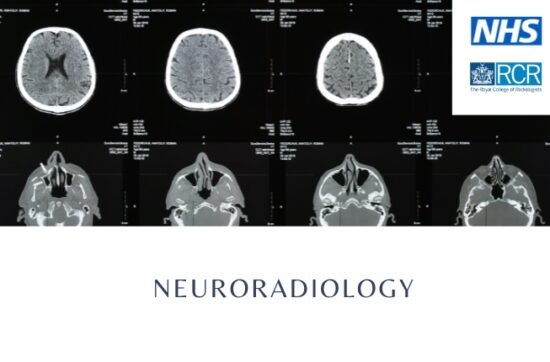 Neuroradiology