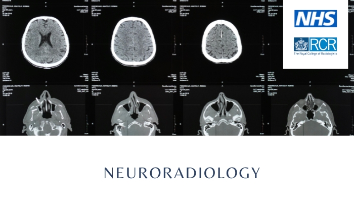 Neuroradiology